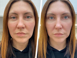 Массаж Батуми