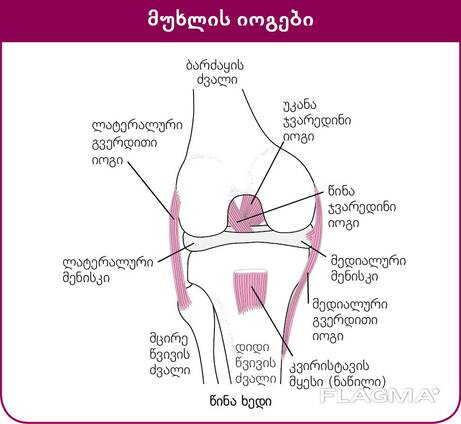სინოვიტი . რევმატოლოგი ირაკლი შელია